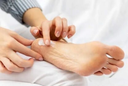 Unlocking the Power of Urea Cream for feet