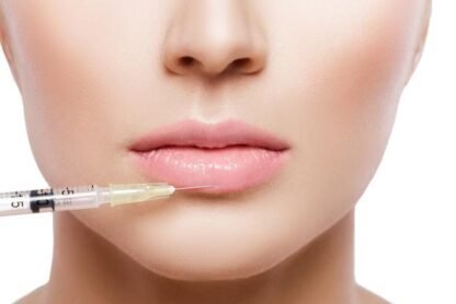 What to Expect Before, During, and After Your Lip Filler Cosmetic Treatment