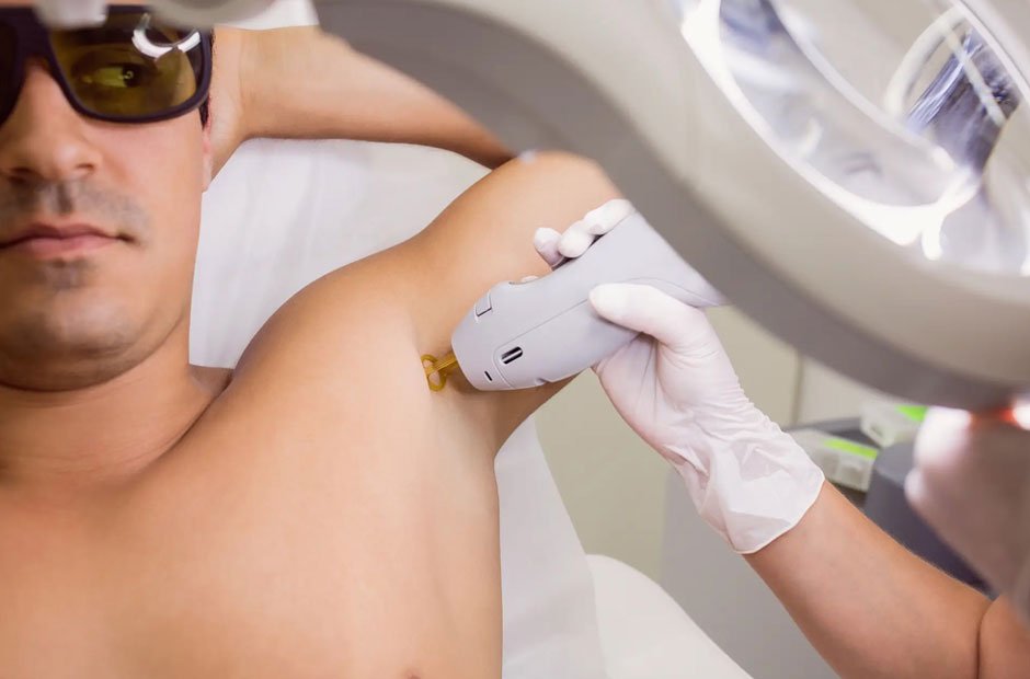 Is Laser Hair Removal for Men in Chicago Right for You?