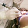 Takeaways from the Suboxone Tooth Decay Lawsuit