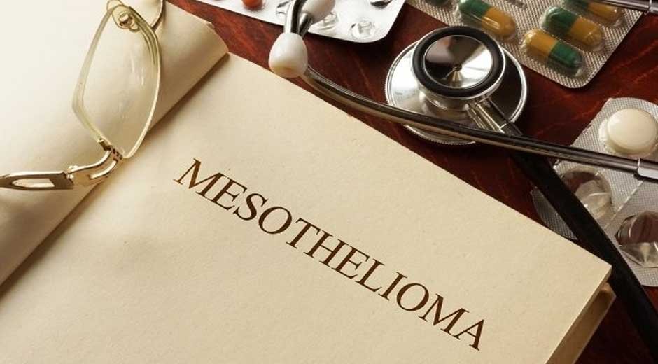 The-Early-Warning-Signs-of-Mesothelioma