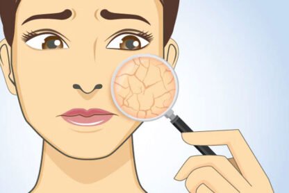 Understanding-the-Reasons-For-Dry-Skin-and-How-to-Treat-It